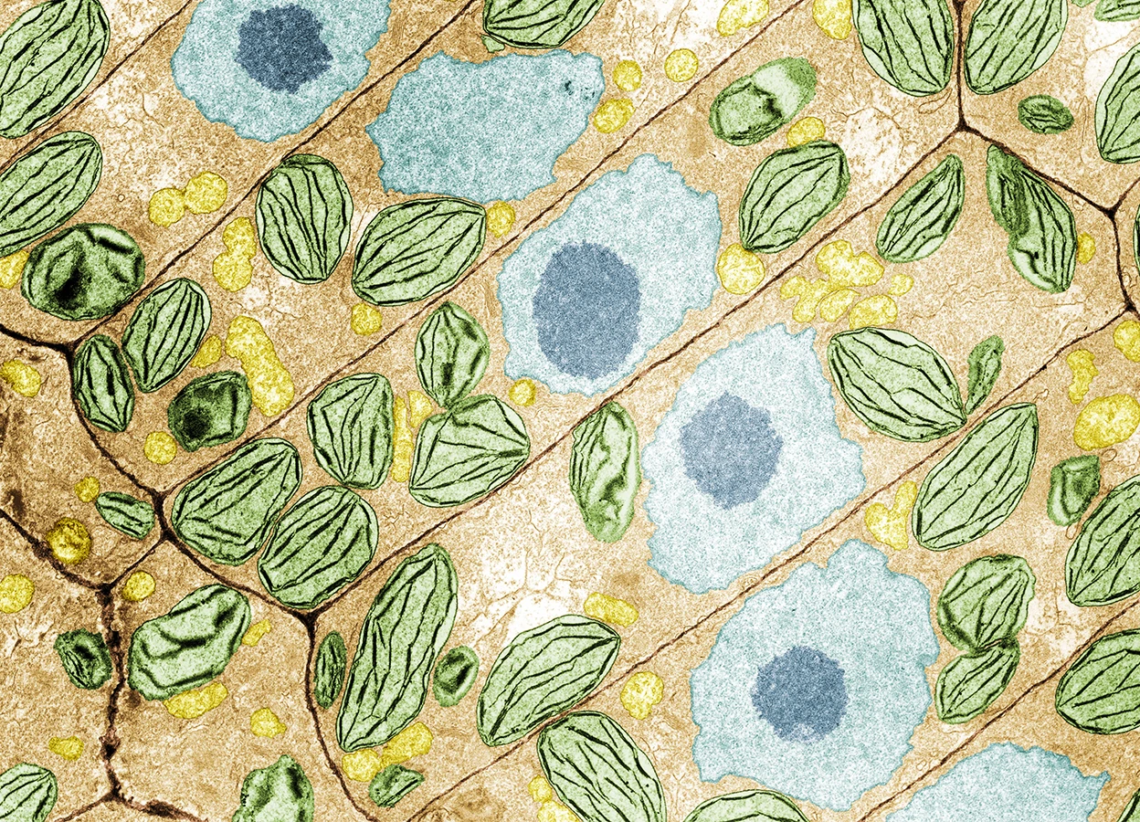 The Dynamic Role of Plant Cell Walls in Growth and Defense